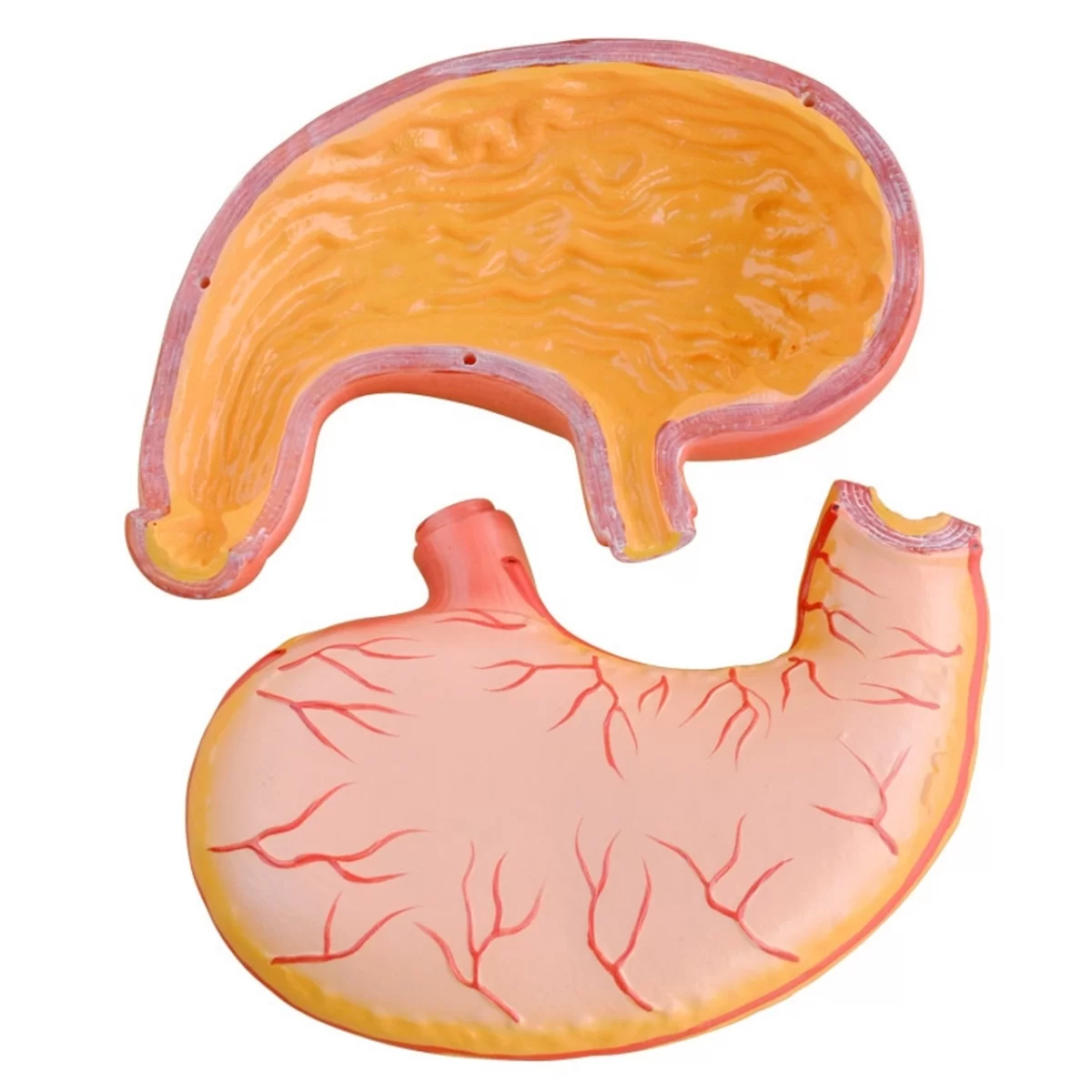 Human Stomach Model 01-1200x1200 Spam the Not-so-sweet Gecko