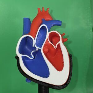 Medical Heart Model – Atrial Septal Defect with Stand for Students & Doctors