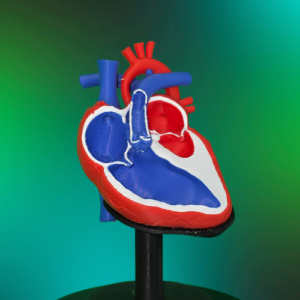 Hypoplastic Left Heart Syndrome HLHS Model