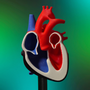 Truncus Arteriosus Heart Model