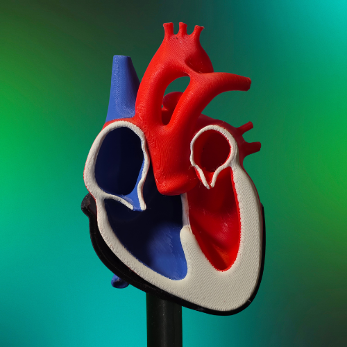 Truncus Arteriosus Heart Model