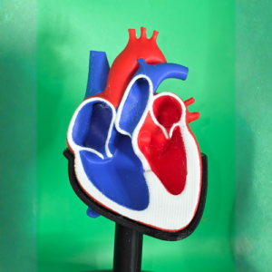 Ventricular Septal Defect (VSD) Heart Model with Stand